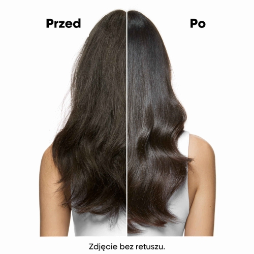 Porównanie efektu przed i po użyciu szamponu L’Oréal Scalp Advanced Anti-Discomfort.