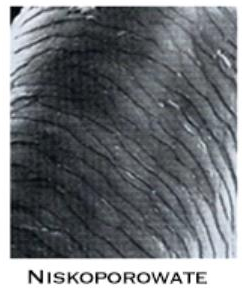 wygląd pod mikroskopem włosa Niskoporowatego